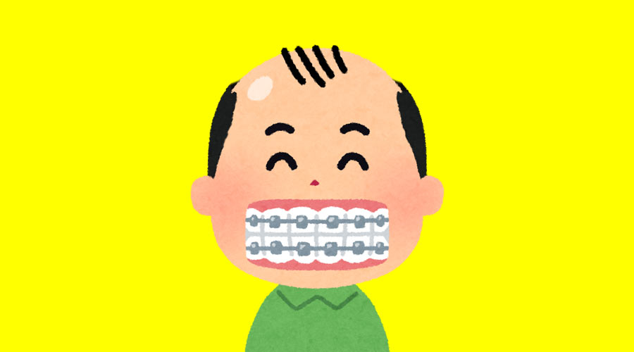 【ハゲ速報】歯列矯正とハゲ治療に月3万円つぎ込んだ結果ｗｗｗ