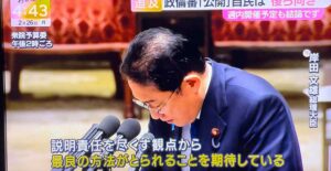 【ハゲ速報】岸田総理、ストレスでハゲ散らかしてしまう（画像あり）